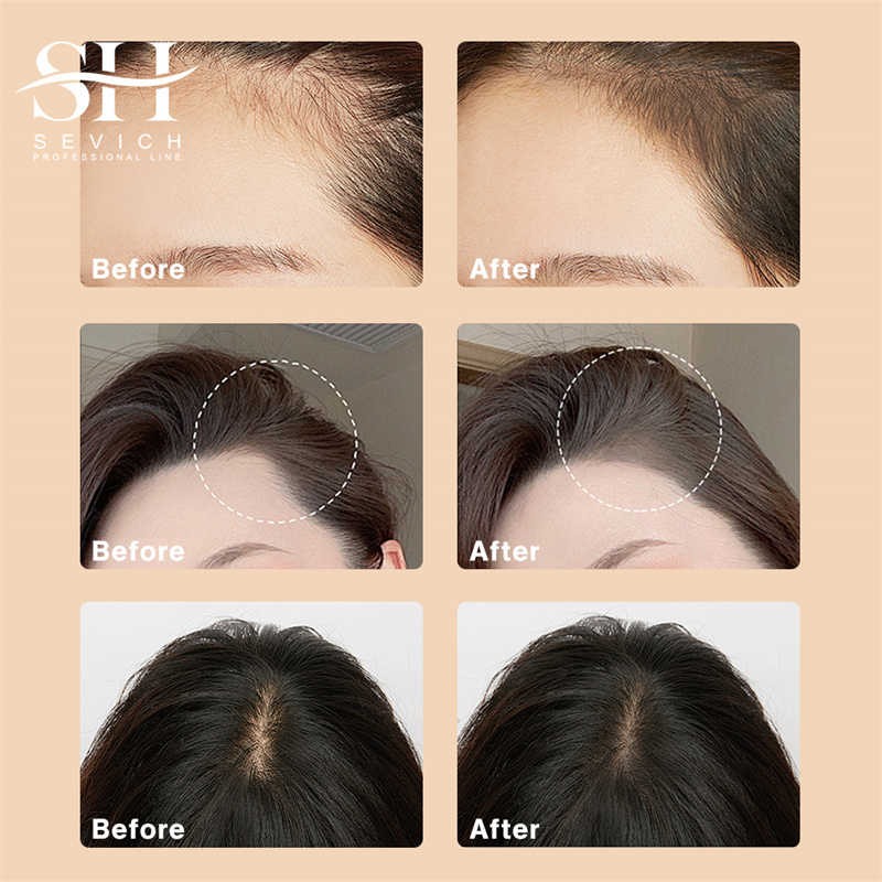 SEVICH 12g Hairline Powder Wit - Rooting Hormone Powder recension och pris